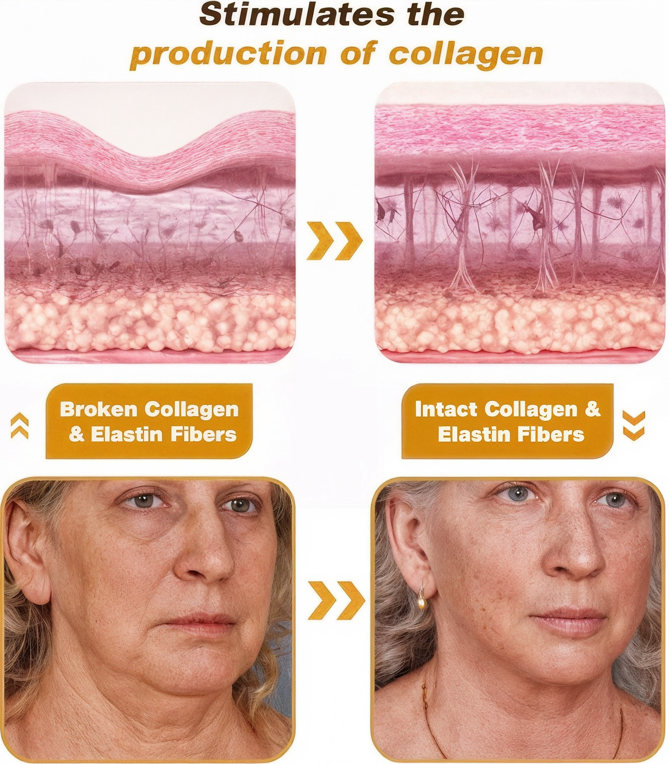 LAYZA™ HOUKEA Botox Wrinkle Cream (Original)